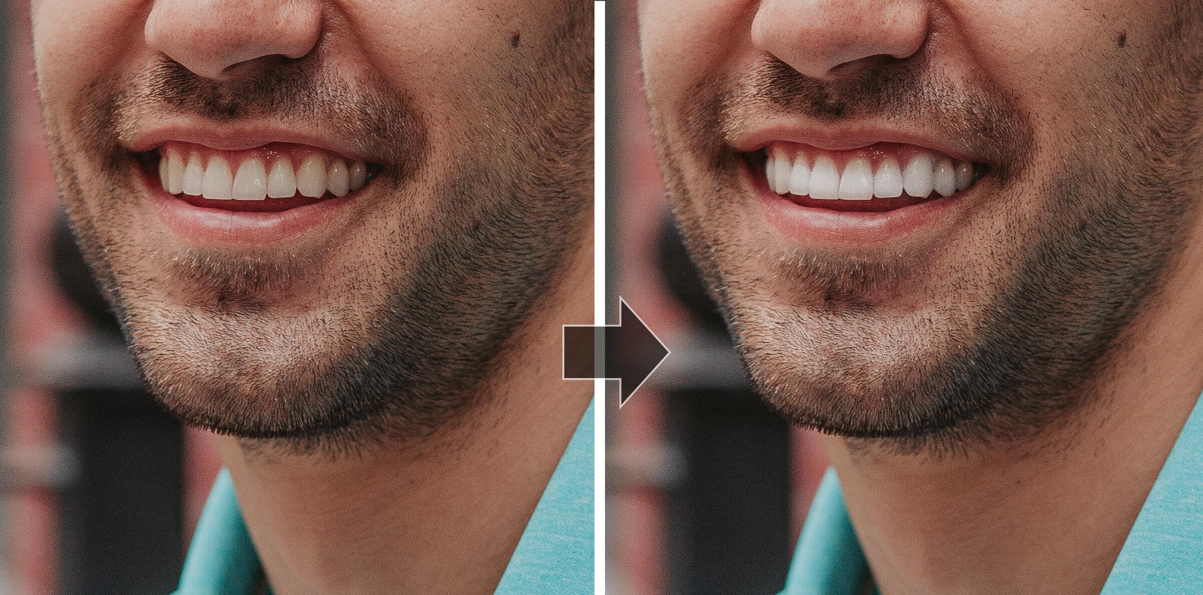 before and after photo of retouching options